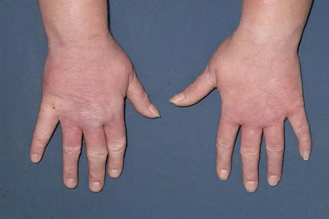 Skin Swabs